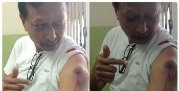 नयाँबानेश्वरमा प्रहरीको गोली लागी कान्तिपुर टिभीका पत्रकार घाइते