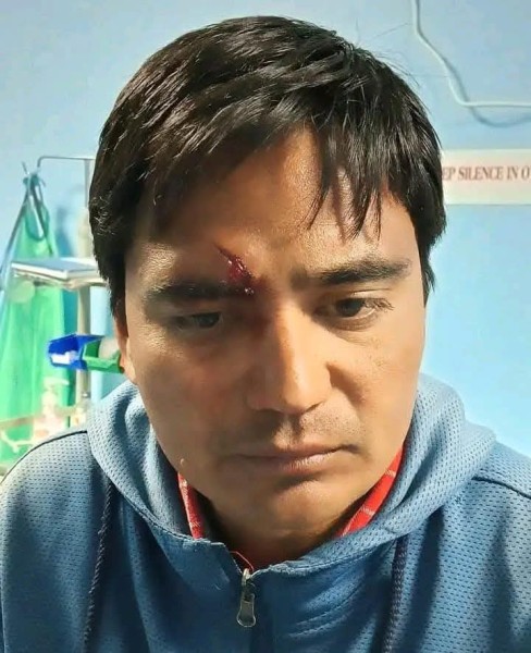 पत्रकार महासंघ बझाङका अध्यक्ष सिंहमाथि चक्कु प्रहार